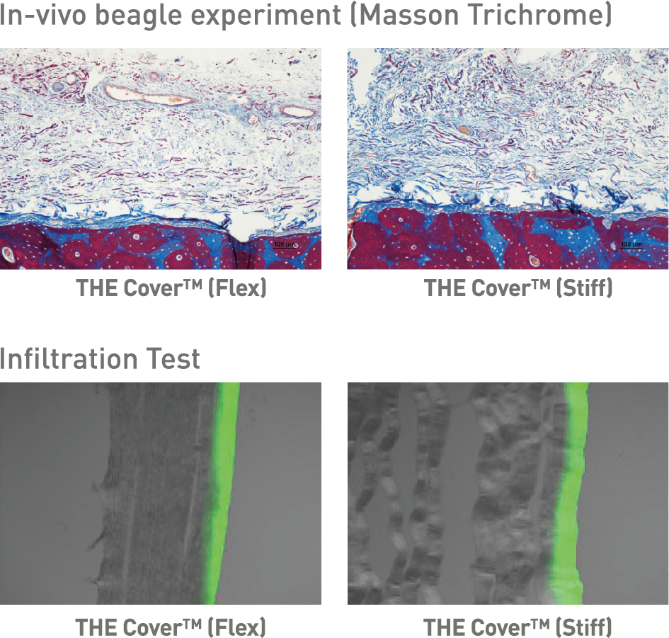 THE_Cover_invivo-infiltration-test-1